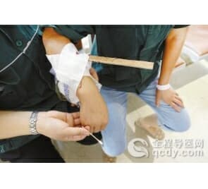 木條彈出刺穿女工手臂 仁慈醫(yī)院顯微鏡下7小時取完碎屑